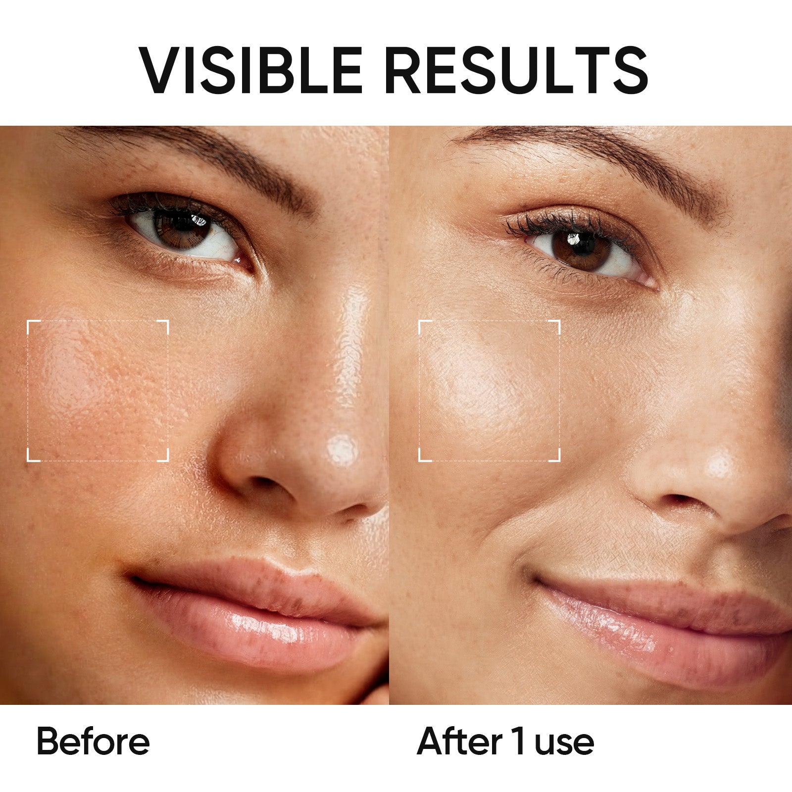 Dual Clay Blackhead Clearing & Smooth Skin Set 2pcs