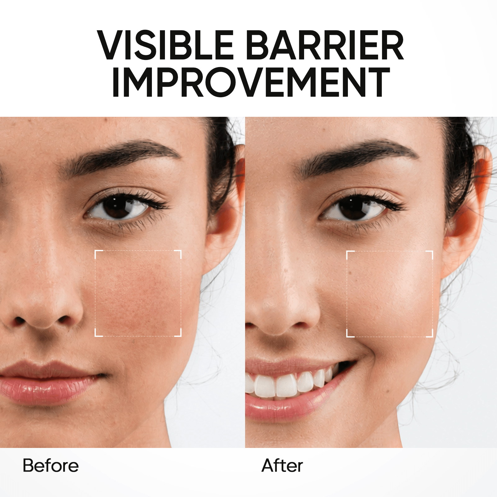 Gel Hidratante Reparador de la Barrera con 5X Ceramidas
