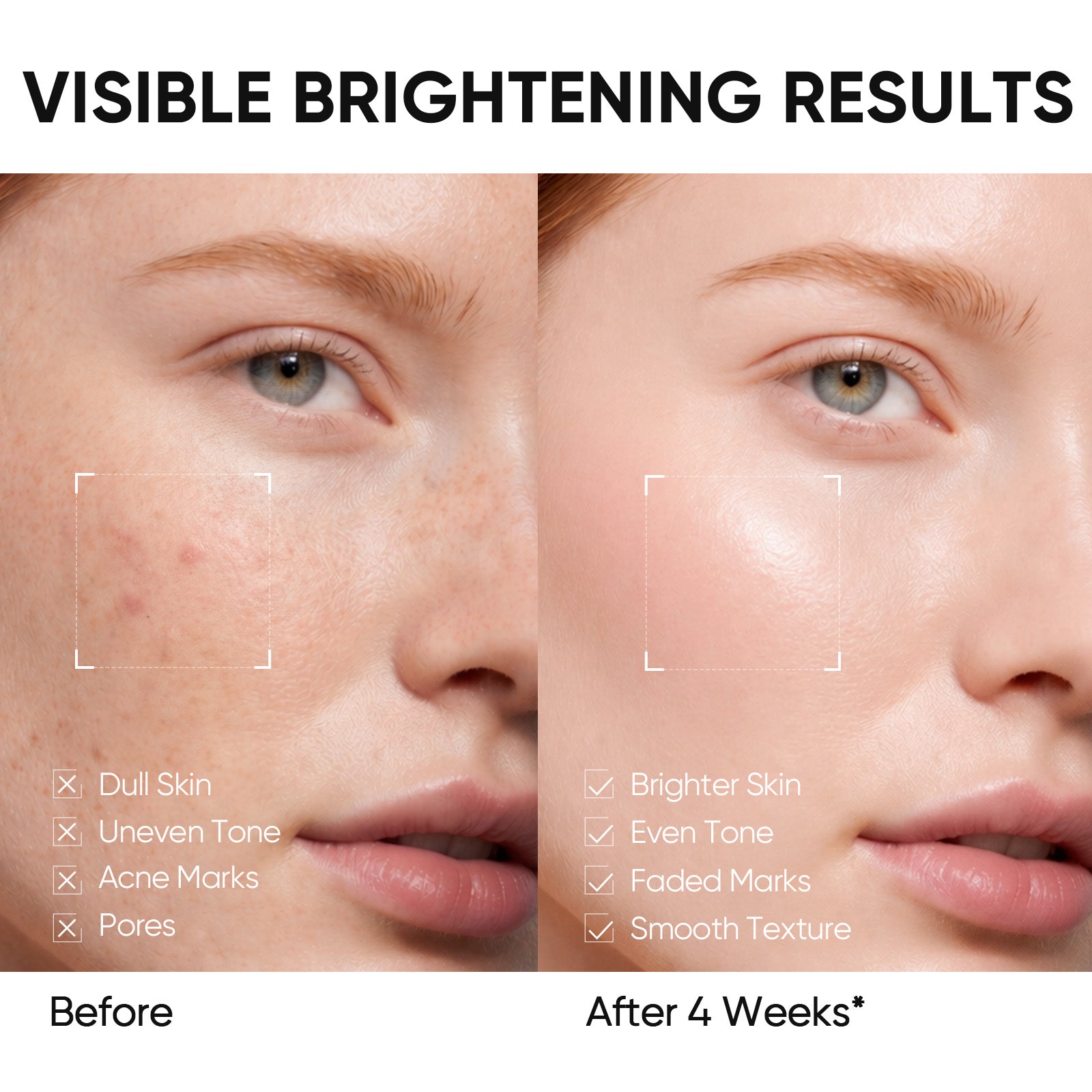 Niacinamide Brightening Set