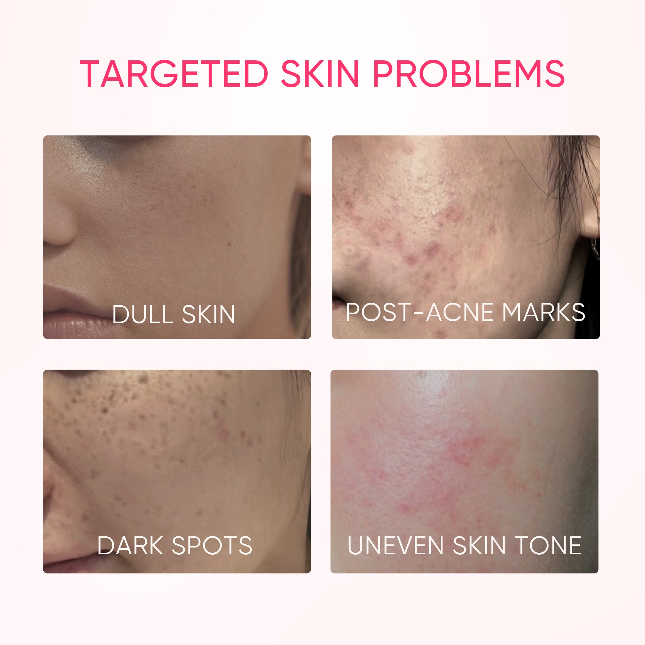 Daily Niacinamide Brightening Glow System Set
