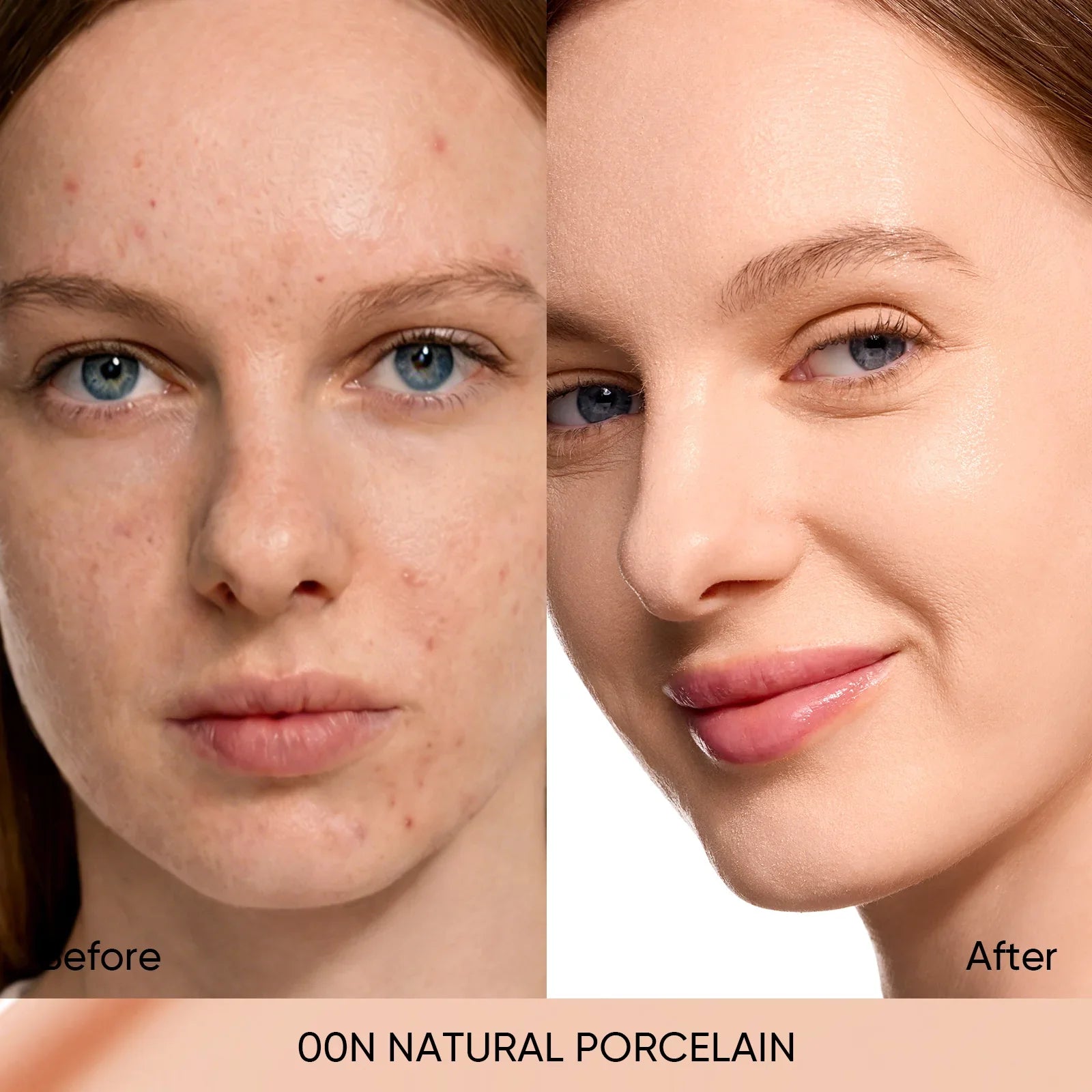 00N   Natural Porcelain