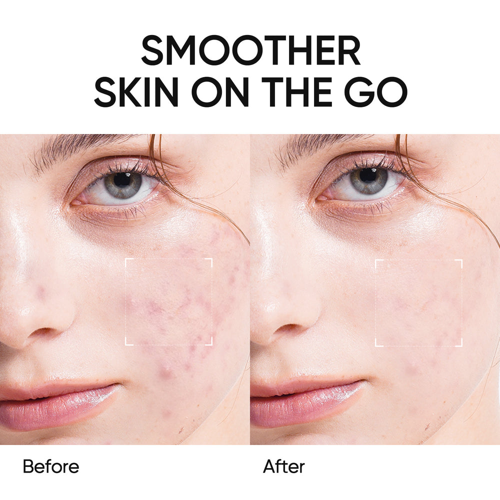 Toallitas exfoliantes AHA, BHA y PHA