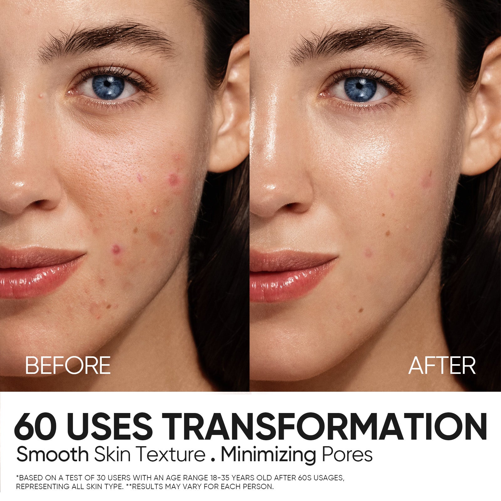 12% AHA BHA PHA LHA Peeling Solution Serum