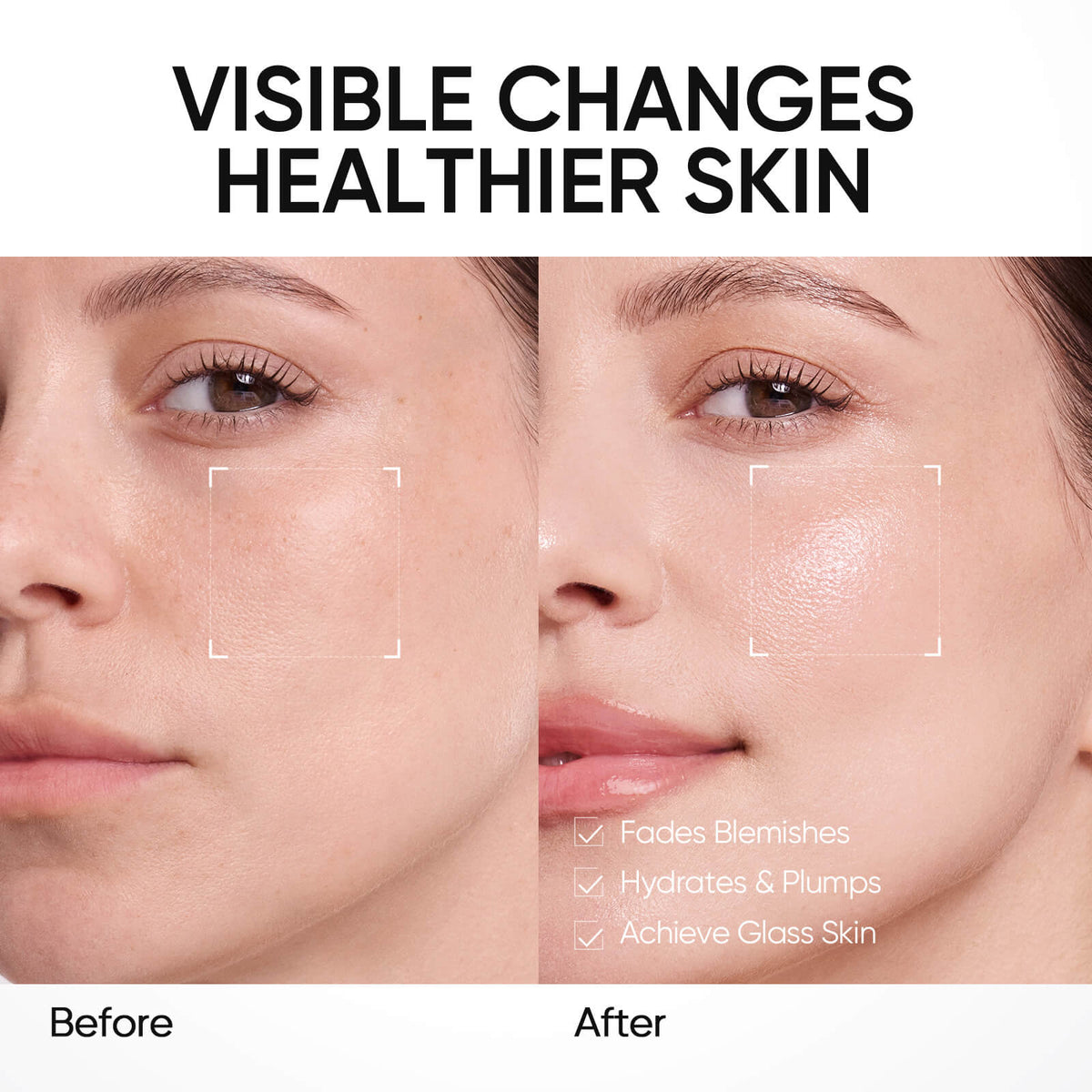 Crema hidratante en gel PDRN para iluminar, suavizar y aportar humedad