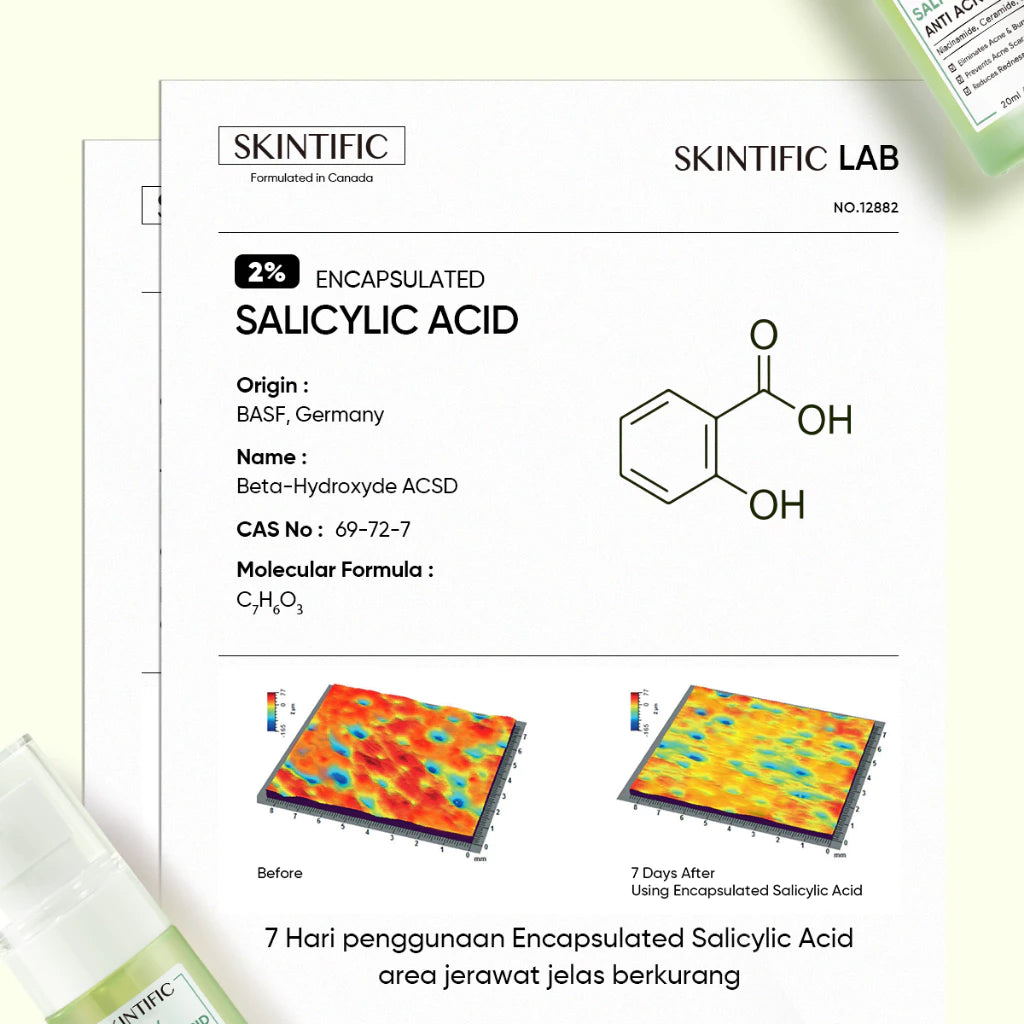 Sérum Antiacné con 2% Ácido Salicílico